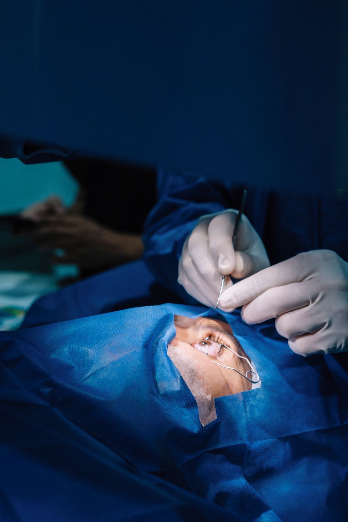 Ophthalmic surgeon performing a cataract procedure